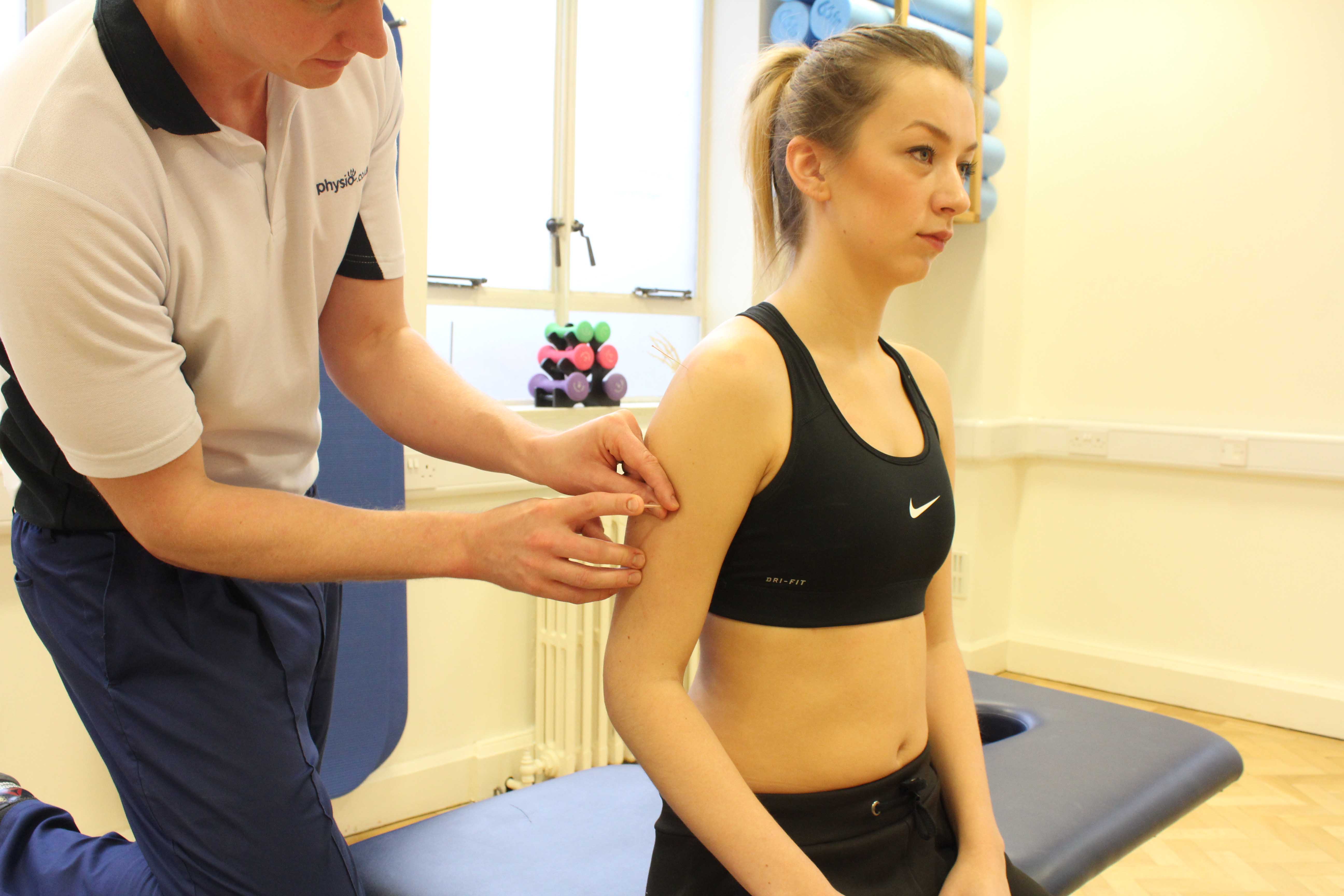 Specialist physiotherapist applying accupuncture to relieve symptoms of pain