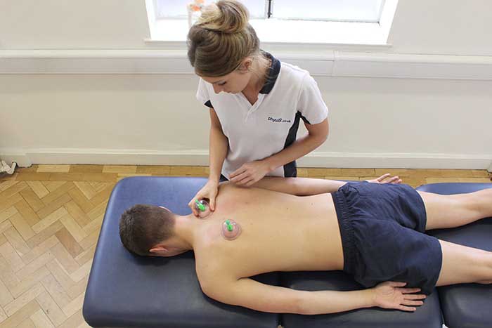 Customer receiving back massage using cupping technique in Manchester Physio Clinic