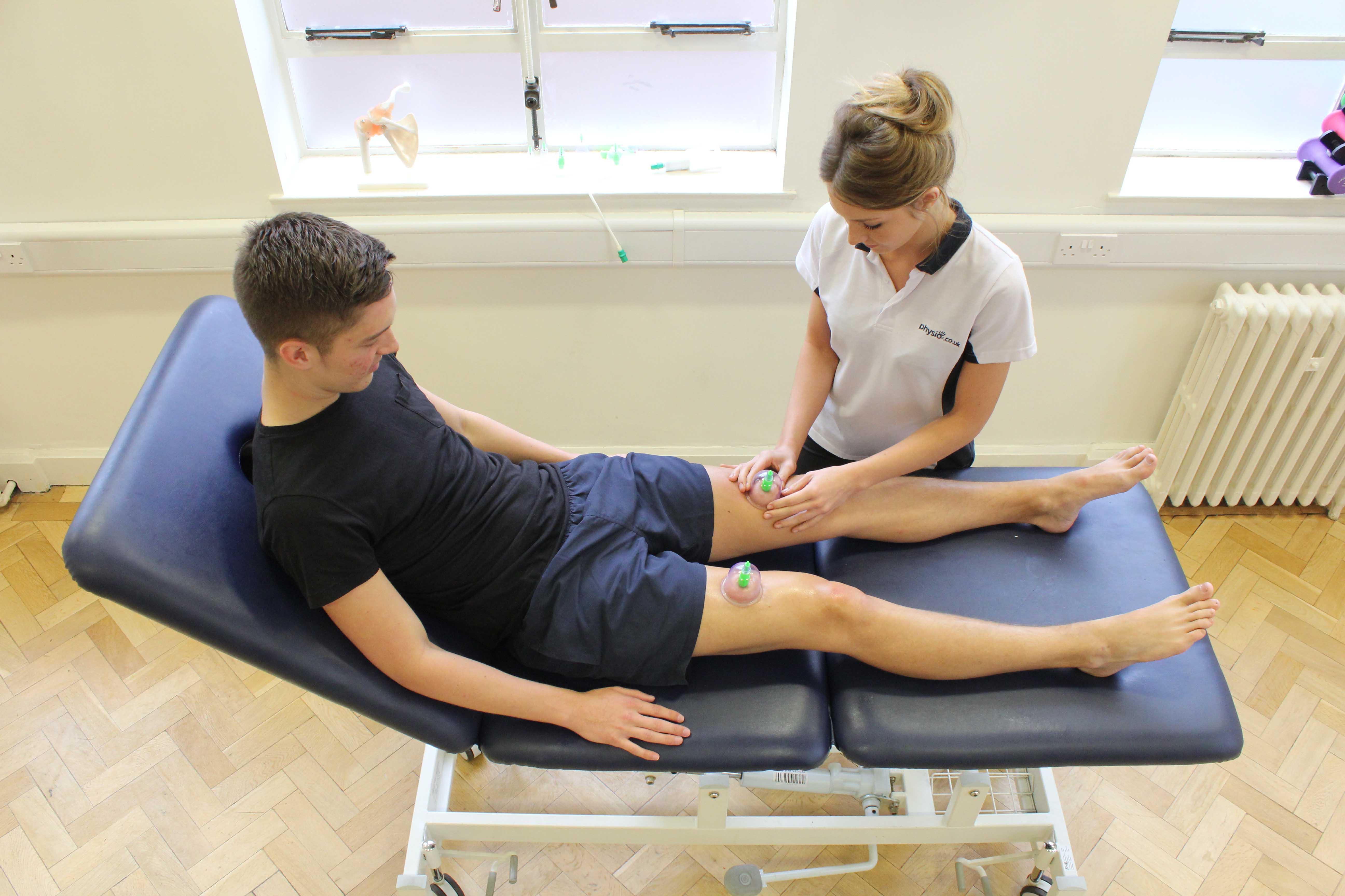 Cupping massage technique applied to the quadricep muscles by specialist therapist