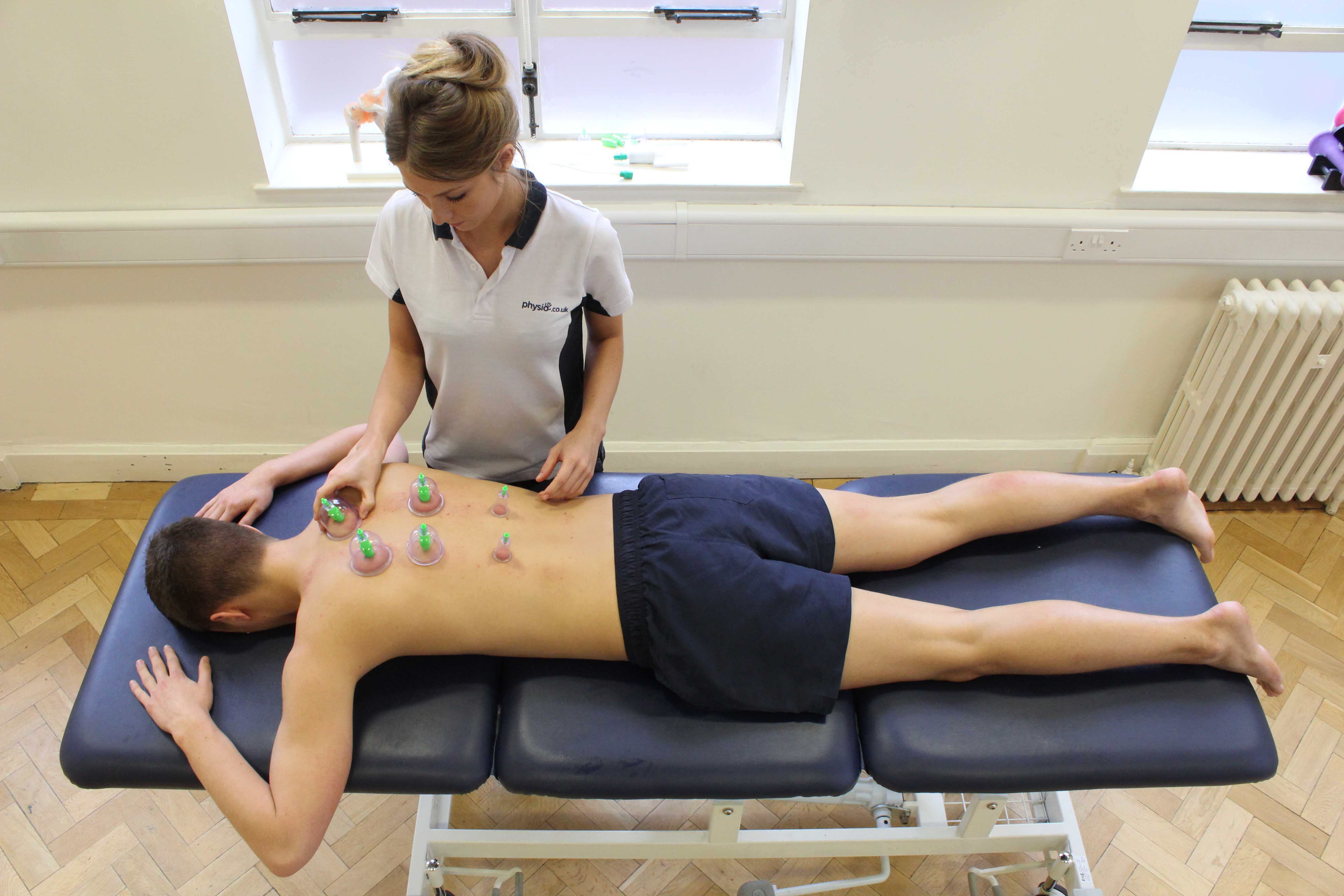 Cupping massage technique applied to the upper back muscles Cupping massage technique applied to the upper back muscles
